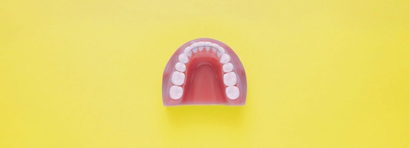 Unterkieferprothese aus Kunststoff mit weißen Zähnen auf gelbem Hintergrund. Kieferorthopädische Behandlungsmöglichkeit in der Kieferorthopädie an den Erlanger Höfen.