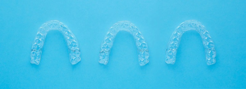 3 transparente Aligner-Zahnschienen – unsichtbare Zahnspange für Erwachsene und Jugendliche in Erlangen.